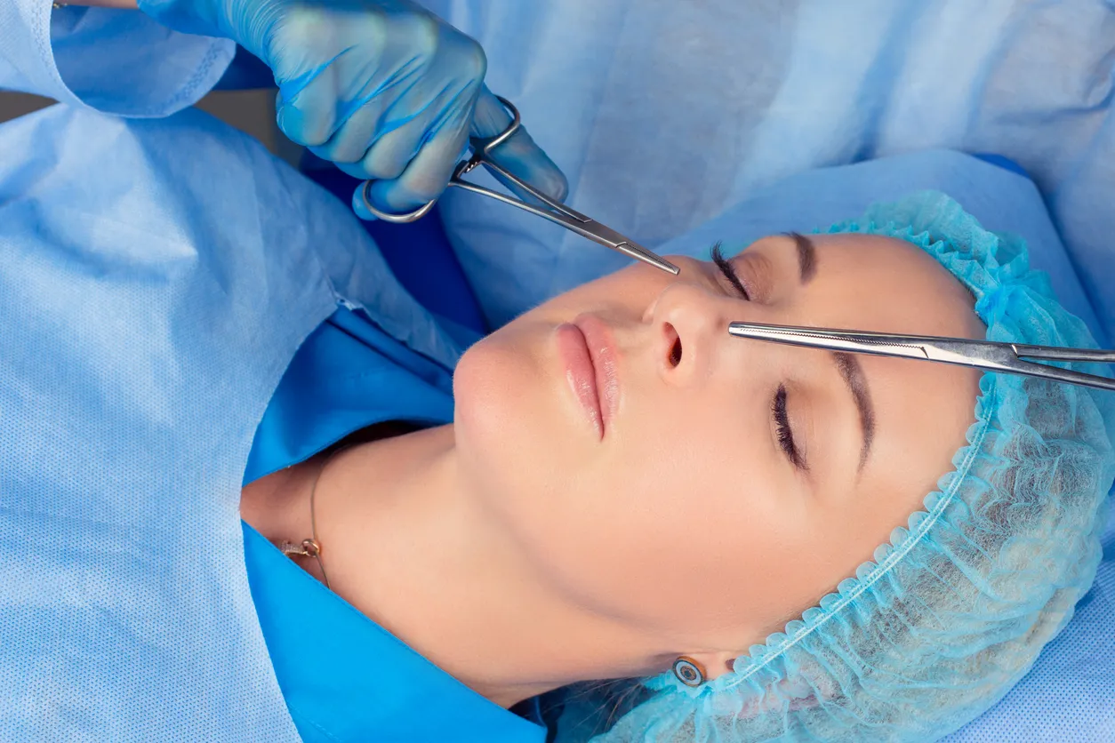 Rhinoplastie, lifting